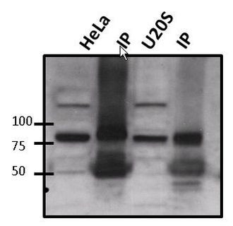 ATRIP Antibody in Immunoprecipitation (IP)