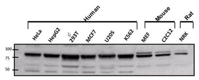 ATRIP Antibody in Western Blot (WB)