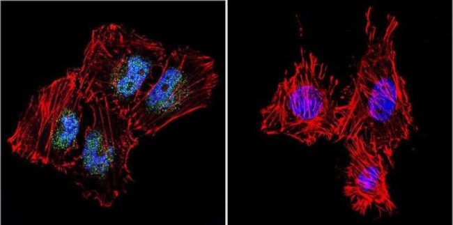 ATRIP Antibody in Immunocytochemistry (ICC/IF)