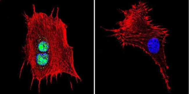 ATRIP Antibody in Immunocytochemistry (ICC/IF)