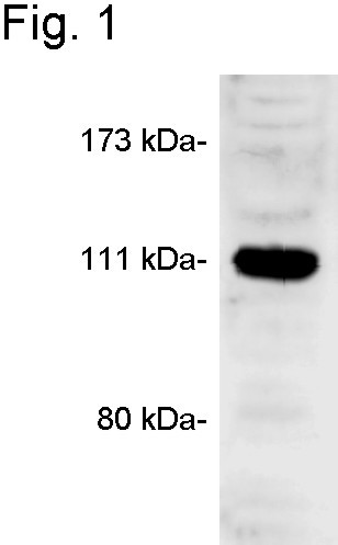 CASK Antibody in Western Blot (WB)