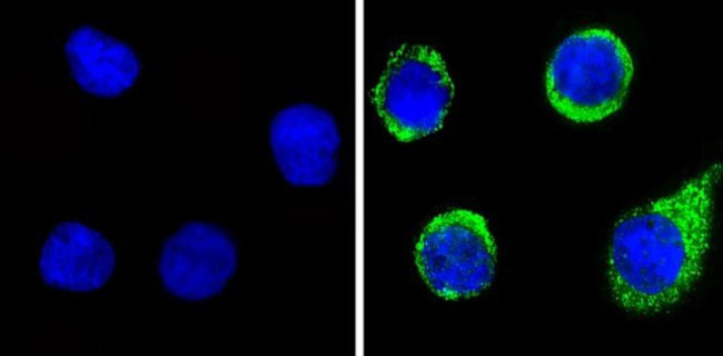 Angiostatin Antibody in Immunocytochemistry (ICC/IF)