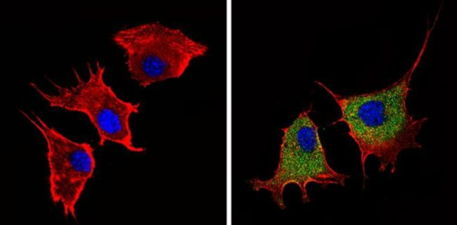 Angiostatin Antibody in Immunocytochemistry (ICC/IF)