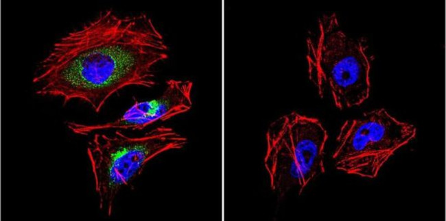 LAMP2 Antibody in Immunocytochemistry (ICC/IF)