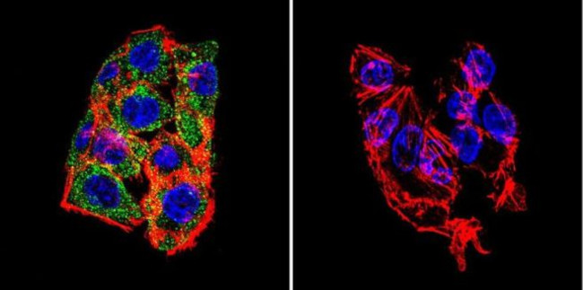 LAMP2 Antibody in Immunocytochemistry (ICC/IF)