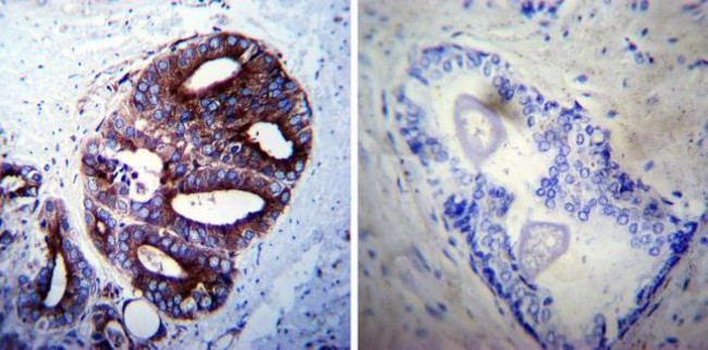 LAMP2 Antibody in Immunohistochemistry (Paraffin) (IHC (P))