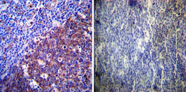 LAMP2 Antibody in Immunohistochemistry (Paraffin) (IHC (P))