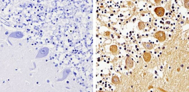 beta-Arrestin 1,2 Antibody in Immunohistochemistry (Paraffin) (IHC (P))