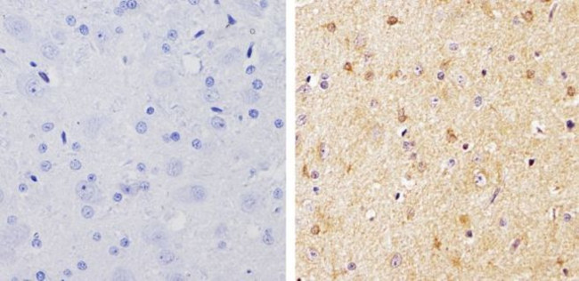 beta-Arrestin 1,2 Antibody in Immunohistochemistry (Paraffin) (IHC (P))