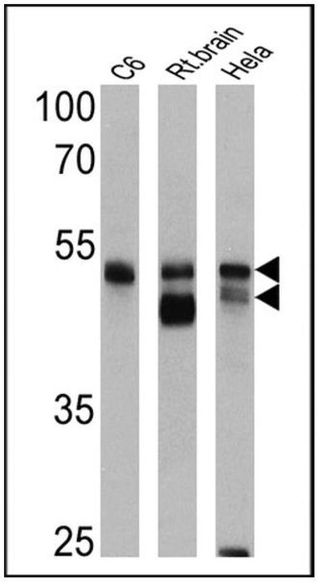 beta-Arrestin 1,2 Antibody in Western Blot (WB)