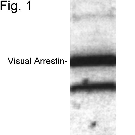 S-arrestin Antibody in Western Blot (WB)