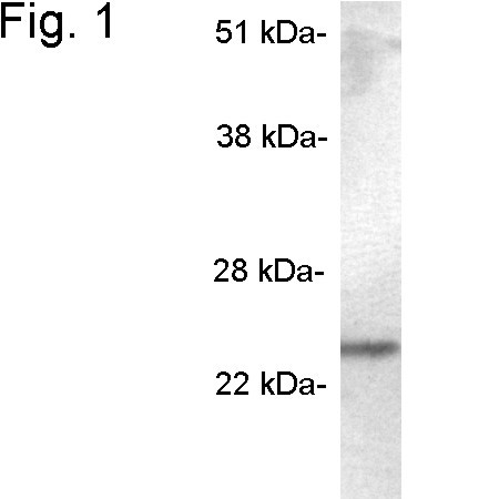 SCAMP5 Antibody in Western Blot (WB)