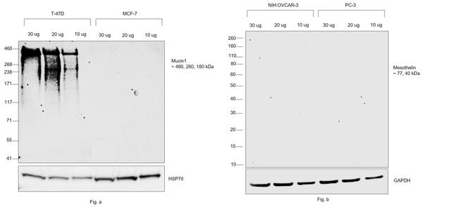 Human Kappa Light Chain Secondary Antibody in Western Blot (WB)