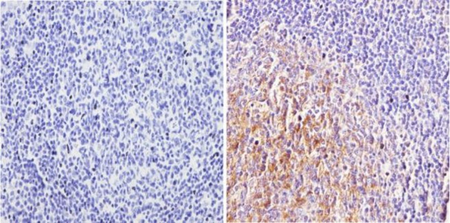 CNR2 Antibody in Immunohistochemistry (Paraffin) (IHC (P))