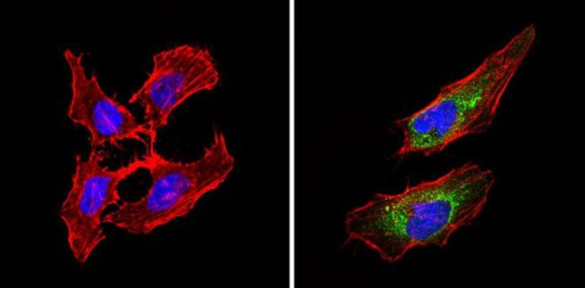 BACE2 Antibody in Immunocytochemistry (ICC/IF)