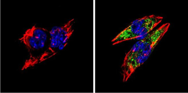 BACE1 Antibody in Immunocytochemistry (ICC/IF)