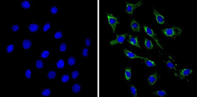 VAMP3 Antibody in Immunocytochemistry (ICC/IF)