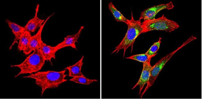 VAMP3 Antibody in Immunocytochemistry (ICC/IF)