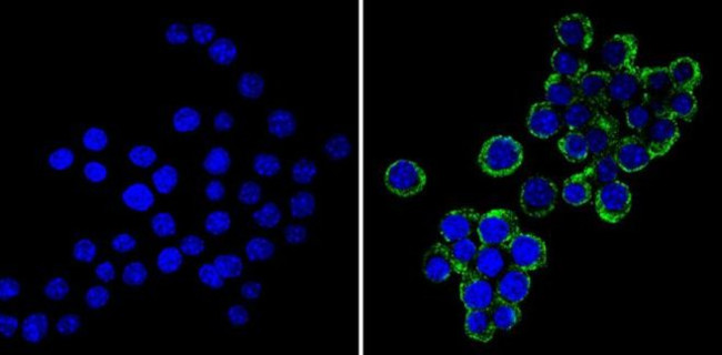 VAMP3 Antibody in Immunocytochemistry (ICC/IF)