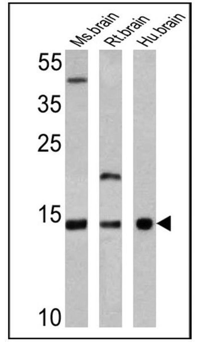 VAMP3 Antibody in Western Blot (WB)