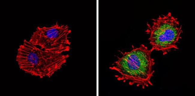 TPH1 Antibody in Immunocytochemistry (ICC/IF)