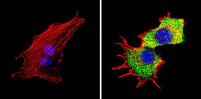 TPH1 Antibody in Immunocytochemistry (ICC/IF)