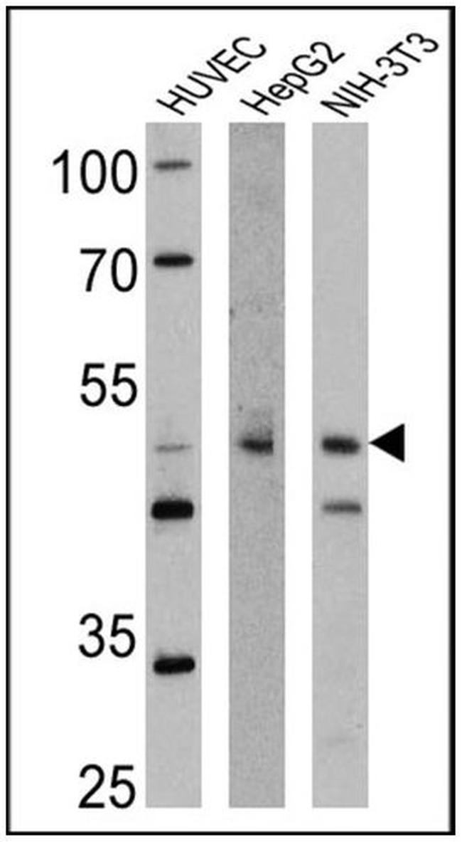 TPH1 Antibody in Western Blot (WB)