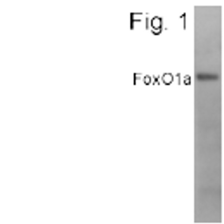 FOXO1 Antibody in Western Blot (WB)