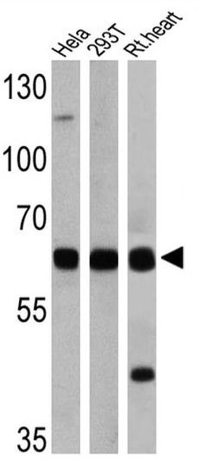 FOXO1 Antibody in Western Blot (WB)