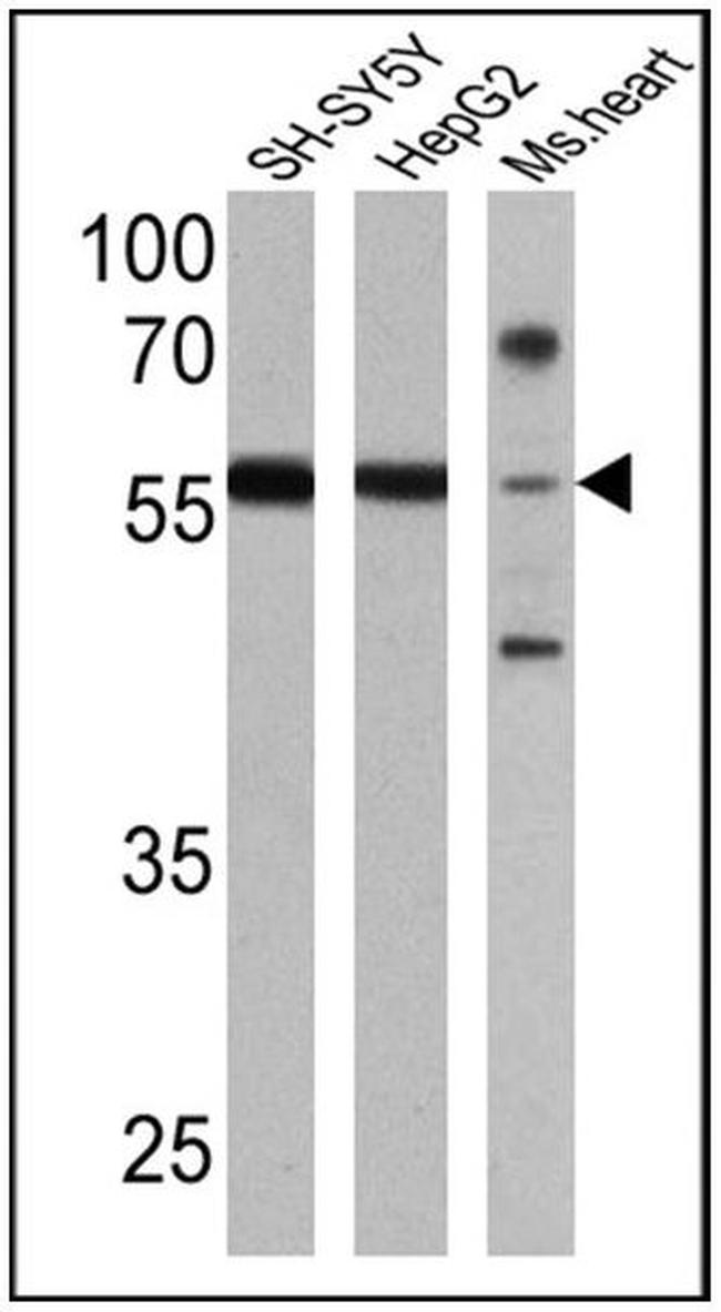 RARB Antibody in Western Blot (WB)