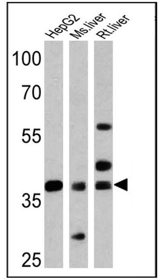 FOXA3 Antibody in Western Blot (WB)