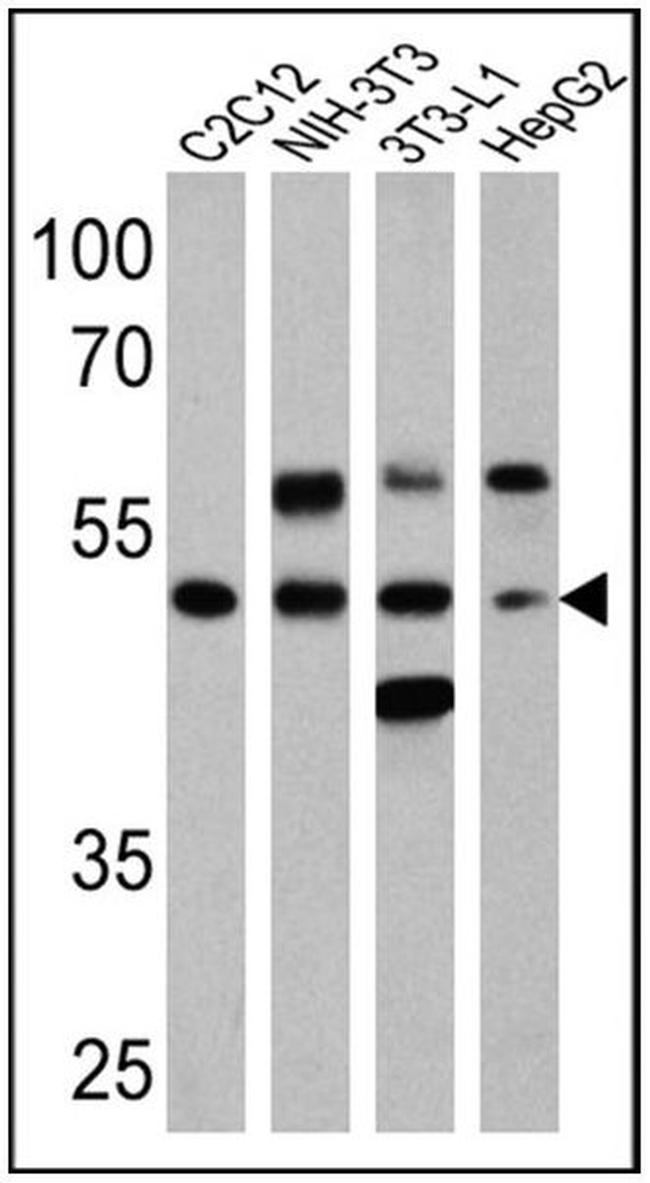 Phospho-PPAR alpha (Ser12) Antibody in Western Blot (WB)