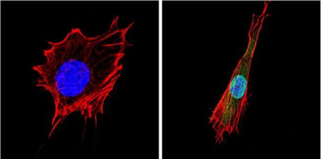 PPAR gamma-2 Antibody in Immunocytochemistry (ICC/IF)