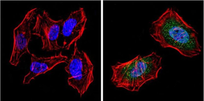 PPAR gamma-2 Antibody in Immunocytochemistry (ICC/IF)