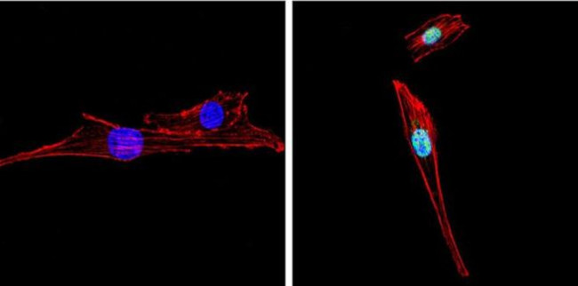 PPAR gamma-2 Antibody in Immunocytochemistry (ICC/IF)