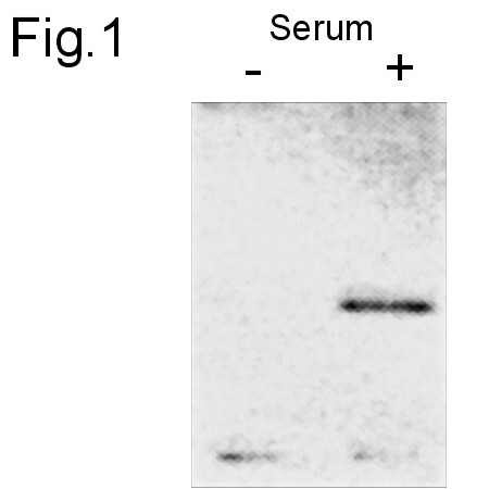 c-Jun Antibody in Western Blot (WB)