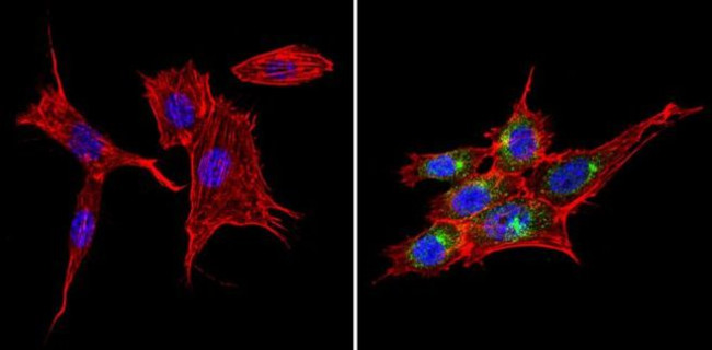 SNX1 Antibody in Immunocytochemistry (ICC/IF)