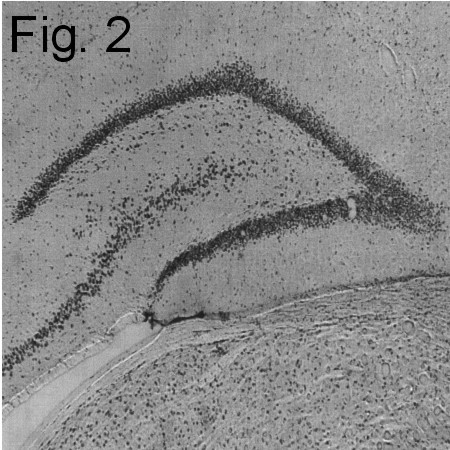 SRC1 Antibody in Immunohistochemistry (IHC)