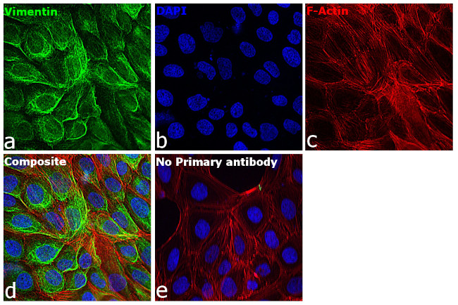 Mouse IgG (H+L) Cross-Adsorbed Secondary Antibody in Immunocytochemistry (ICC/IF)