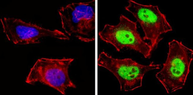 NCoR2 Antibody in Immunocytochemistry (ICC/IF)