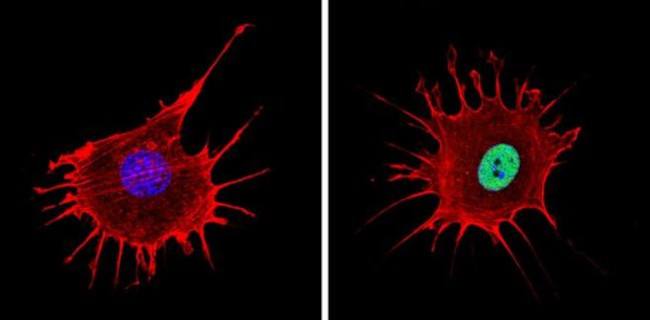 NCoR2 Antibody in Immunocytochemistry (ICC/IF)