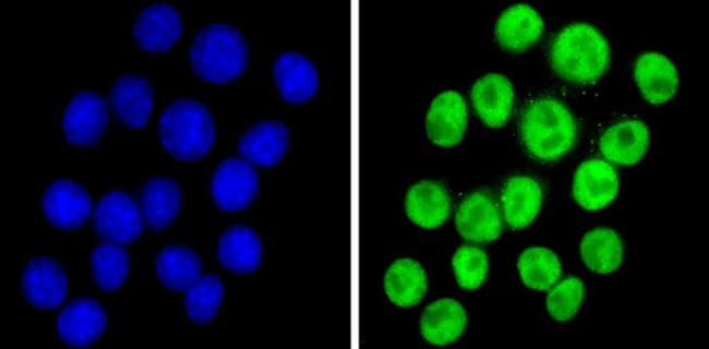 NCoR2 Antibody in Immunocytochemistry (ICC/IF)