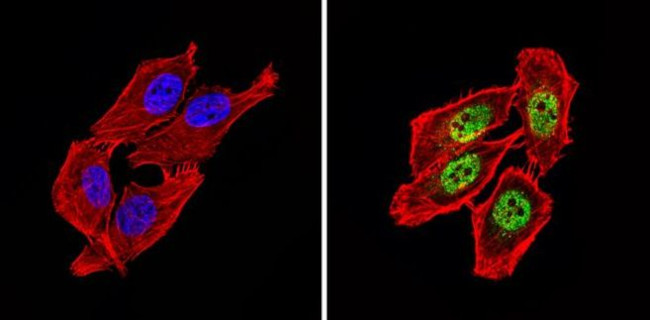 NCoR2 Antibody in Immunocytochemistry (ICC/IF)