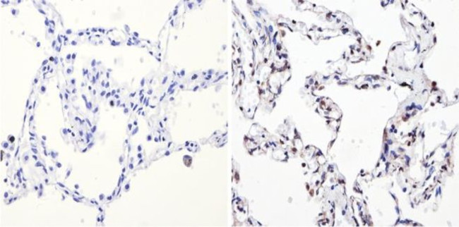 NCoR2 Antibody in Immunohistochemistry (Paraffin) (IHC (P))