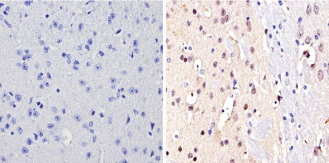 NCoR2 Antibody in Immunohistochemistry (Paraffin) (IHC (P))