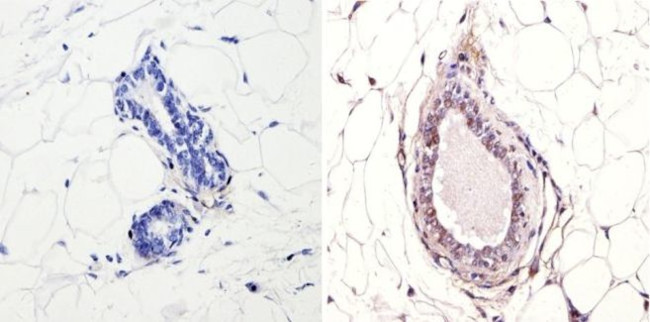 NCoR1 Antibody in Immunohistochemistry (Paraffin) (IHC (P))