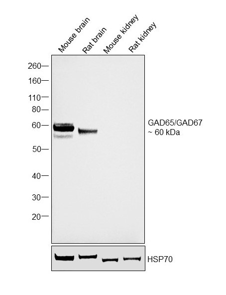 GAD65/GAD67 Antibody