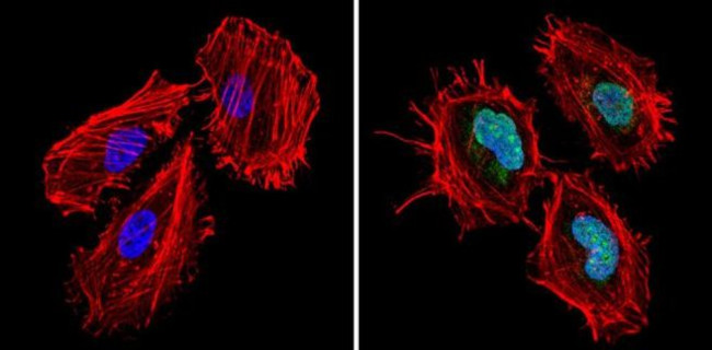 CBP Antibody in Immunocytochemistry (ICC/IF)