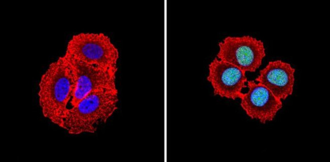 CBP Antibody in Immunocytochemistry (ICC/IF)