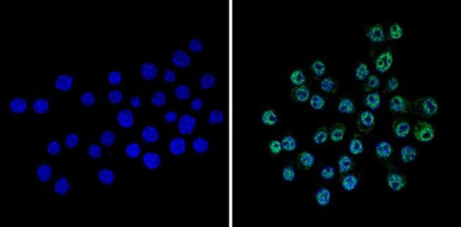 CREB Antibody in Immunocytochemistry (ICC/IF)